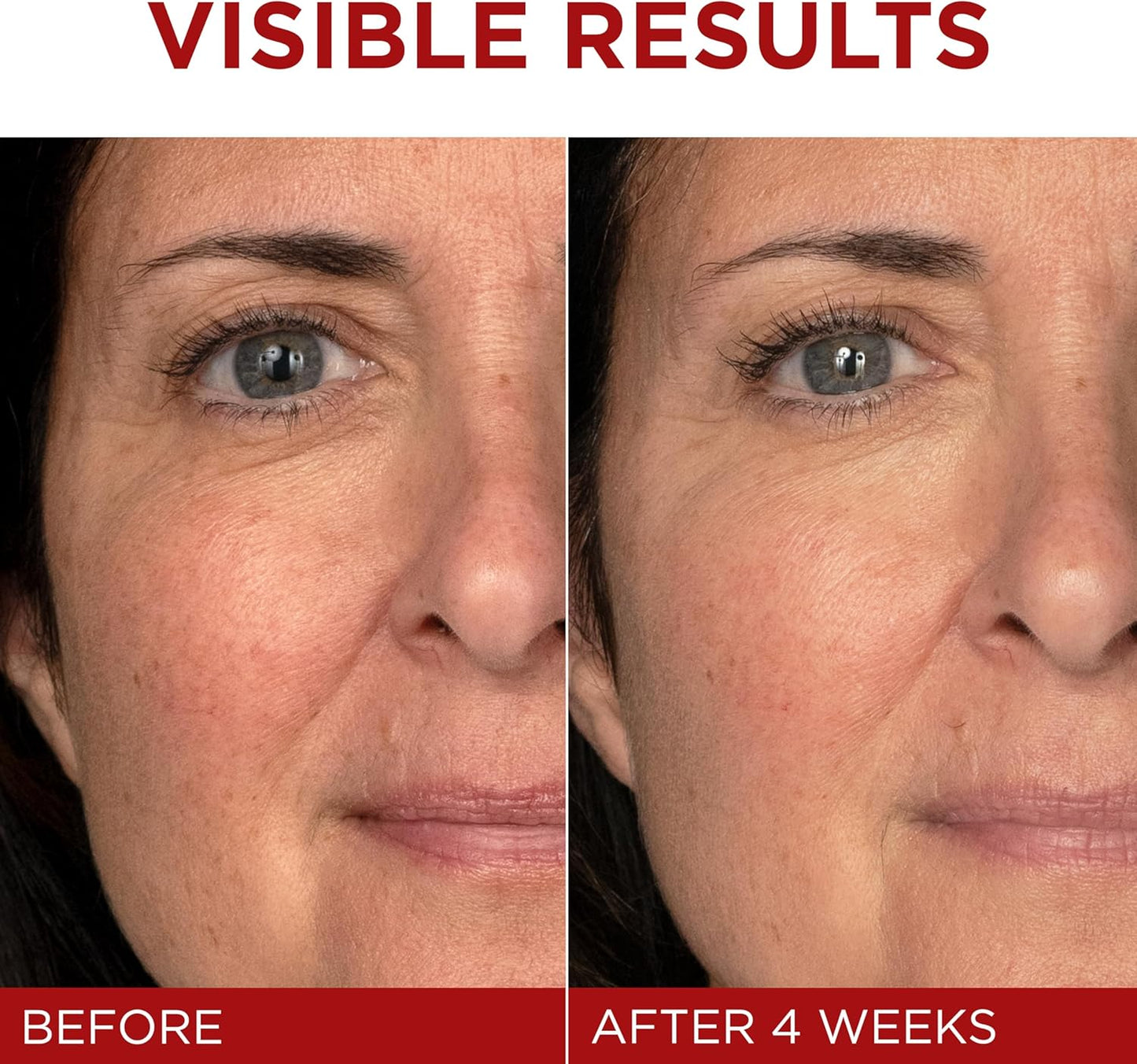 L'Oréal Paris Day Cream, Face Moisturizer with Pro-Retinol, Vitamin C & Hyaluronic Acid, Reduces Look of Wrinkles & Firms Skin, , Revitalift Triple Power LZR, 50ml