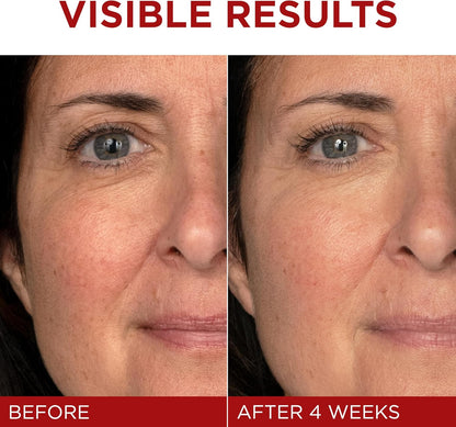 L'Oréal Paris Day Cream, Face Moisturizer with Pro-Retinol, Vitamin C & Hyaluronic Acid, Reduces Look of Wrinkles & Firms Skin, , Revitalift Triple Power LZR, 50ml