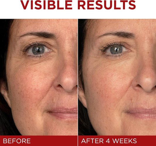 L'Oréal Paris Day Cream, Face Moisturizer with Pro-Retinol, Vitamin C & Hyaluronic Acid, Reduces Look of Wrinkles & Firms Skin, , Revitalift Triple Power LZR, 50ml