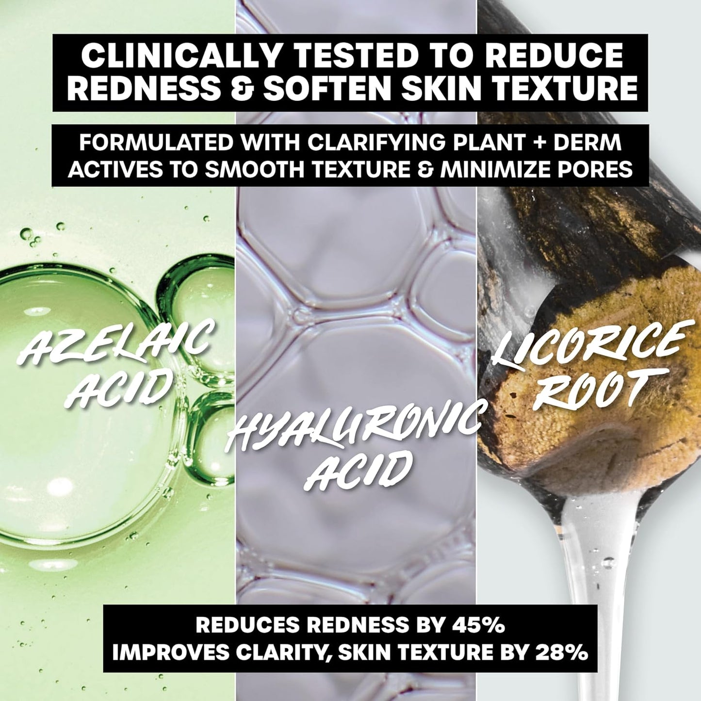 THAYERS Let's Be Clear 水潤臉部保濕霜，含壬二酸和透明質酸，適合混合性至油性肌膚，明顯縮小毛孔，撫平膚質，75 毫升