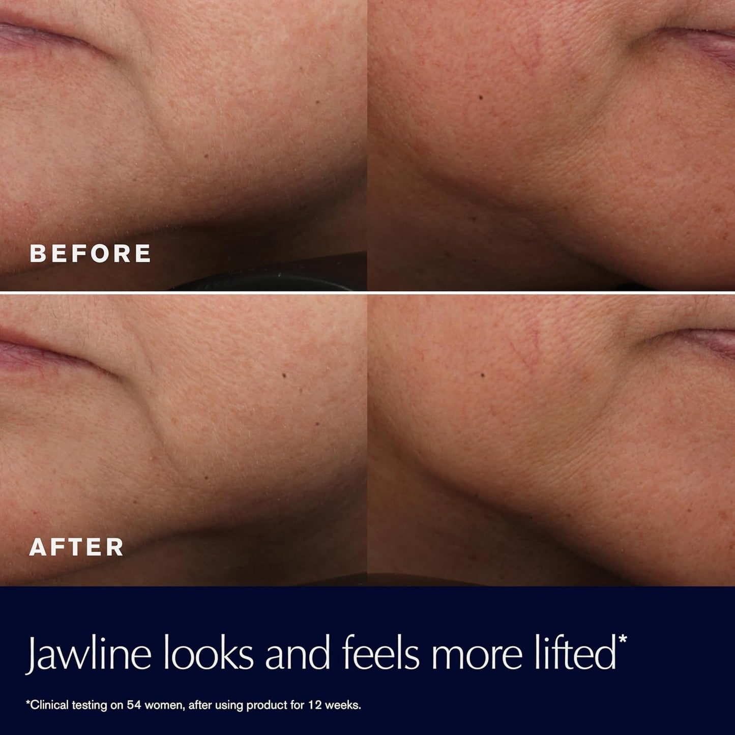 Estée Lauder Revitalizing Supreme+ Youth Power Cream Moisturizer with Hyaluronic Acid & Peptides, Anti Aging