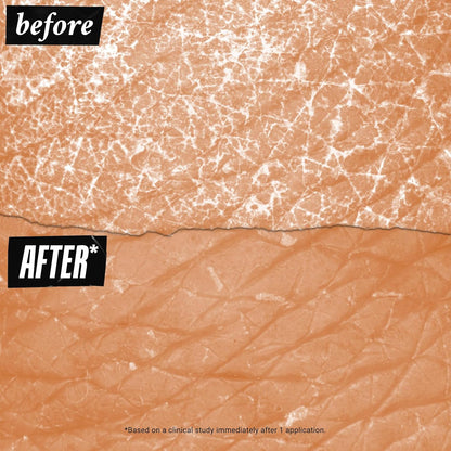 Kiehl's Ultra Body Barrier Repair Cream, Hydrating Body Lotion, Formulated for Sensitive Skin and Safe For Eczema- Fast Absorbing - 250ml