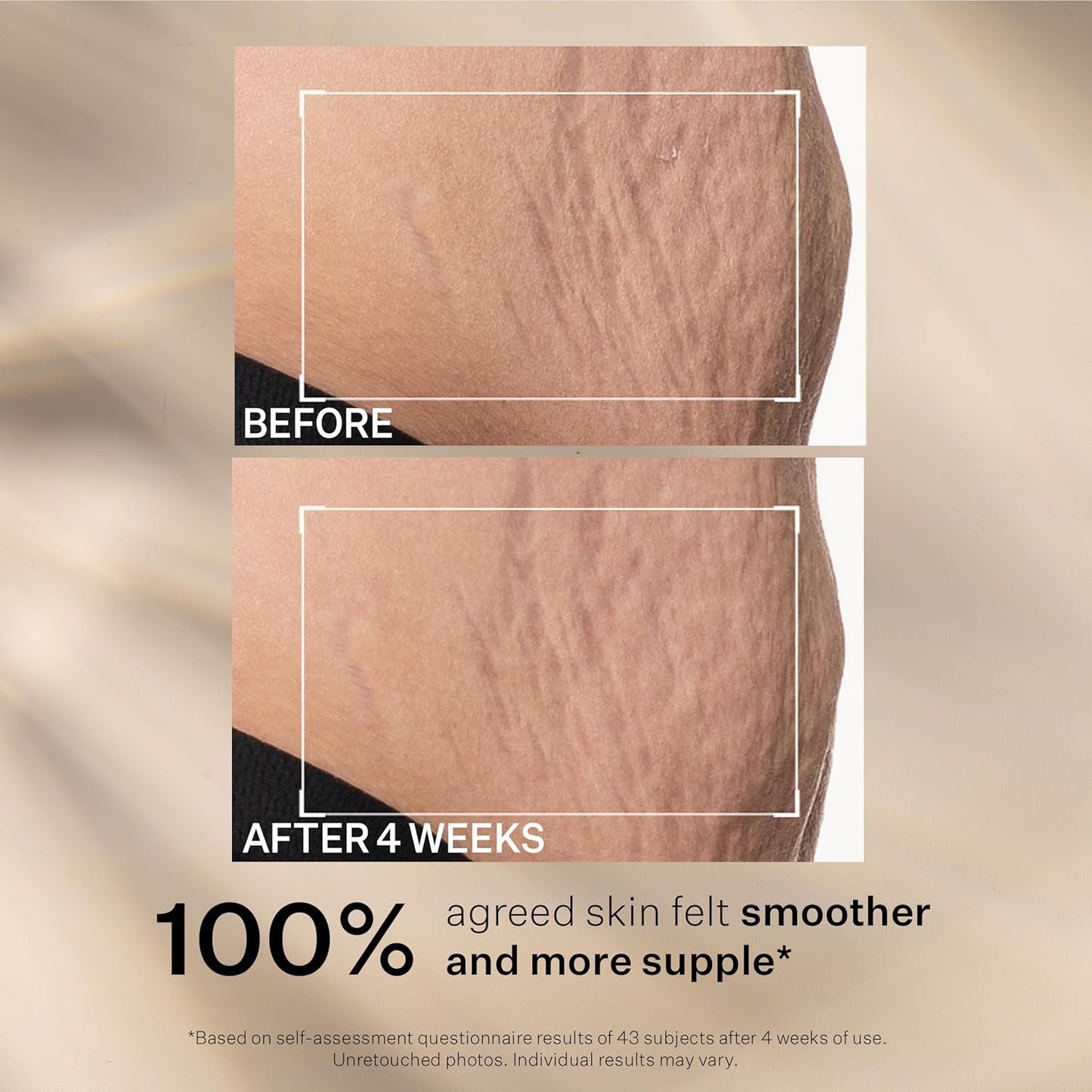 StriVectin SD Advanced™ Plus 強效保濕霜，針對皺紋和妊娠紋，適用於臉部和身體，促進膠原蛋白生成，含勝肽和透明質酸，2 液體盎司（1 包）