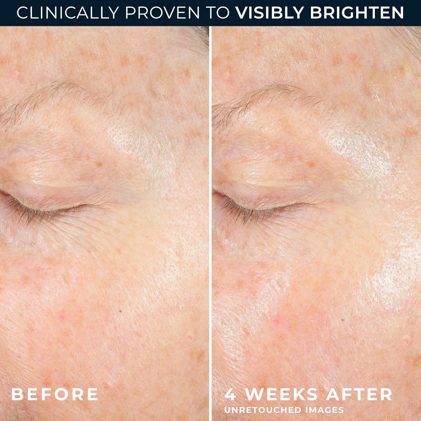 RoC Multi Correxion® Revive + Glow 10% Vitamin C Blend Face Moisturizer, Anti-Aging Gel Cream for Instant Glow, Hypo-Allegenic & Oil-Free Skin Care, 50ML