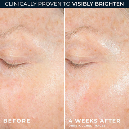 RoC Multi Correxion® Revive + Glow 10% Vitamin C Blend Face Moisturizer, Anti-Aging Gel Cream for Instant Glow, Hypo-Allegenic & Oil-Free Skin Care, 50ML