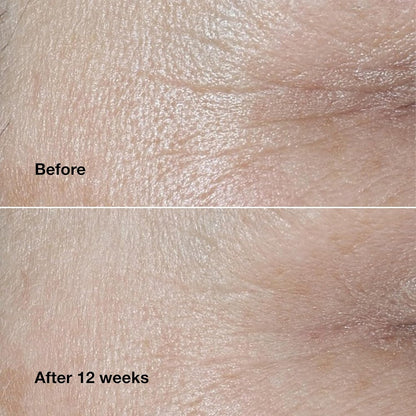 Clinique Smart Clinical Repair Wrinkle Correcting Face Cream With Hyaluronic Acid + Peptides | Anti-Aging + Hydrating