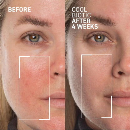 Dr. Brandt Cool Biotic Prebiotic Redness Relief Cream 1.7 oz /50g, White