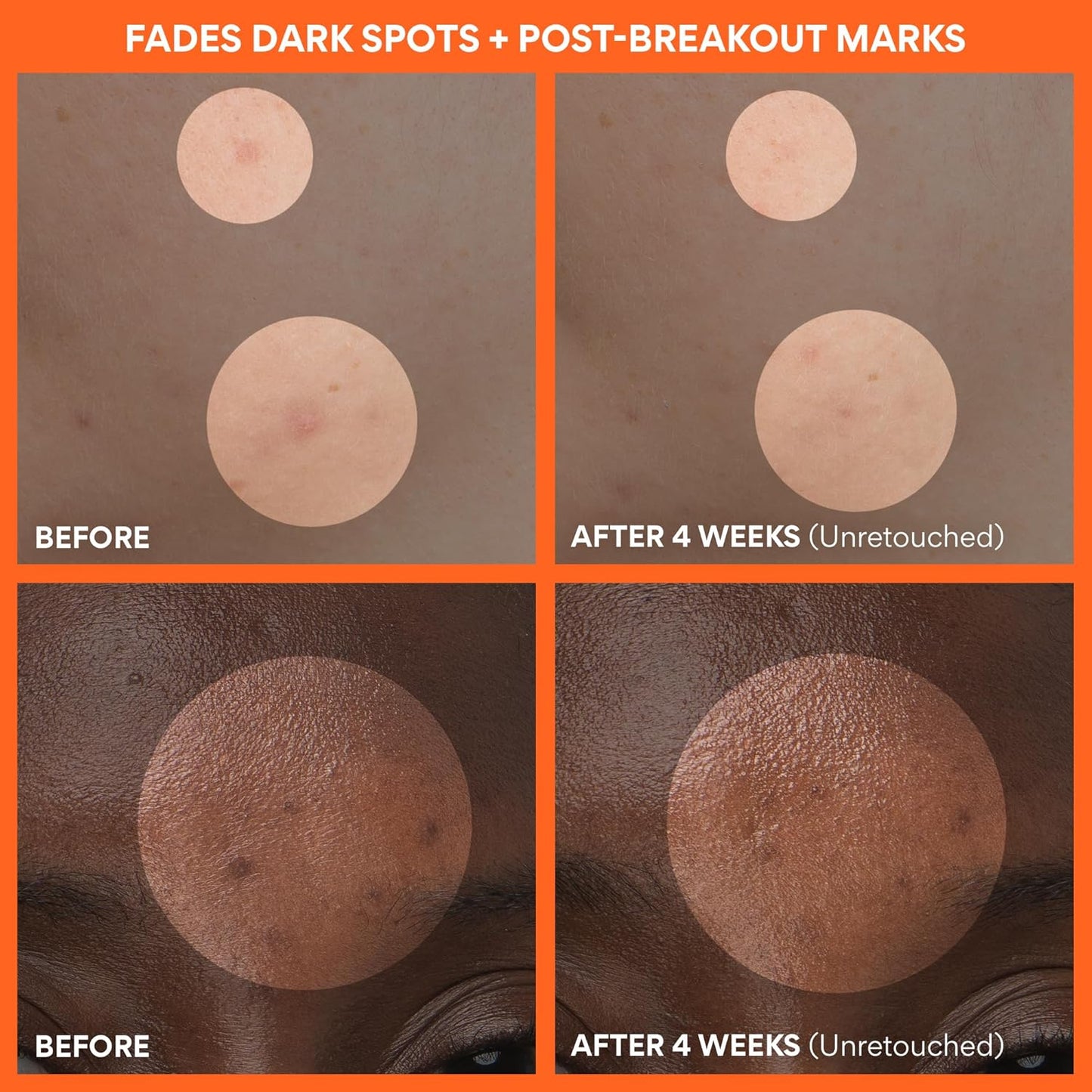 innisfree Green Tea Enzyme Vitamin C Brightening Cream, Korean Face Moisturizer for Dark Spots, Hydration & Radiant Skin