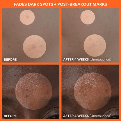 innisfree Green Tea Enzyme Vitamin C Brightening Cream, Korean Face Moisturizer for Dark Spots, Hydration & Radiant Skin