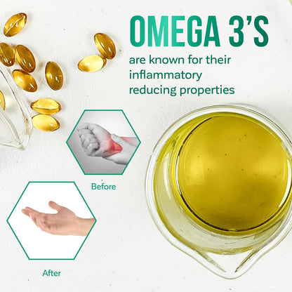 KaLaya 强效止痛霜，含 CSSO 和滚轮按摩球，适用于背部、颈部、肌肉、肩部、手部和膝盖，含有天然活性成分、止痛和抗炎成分（100 克）