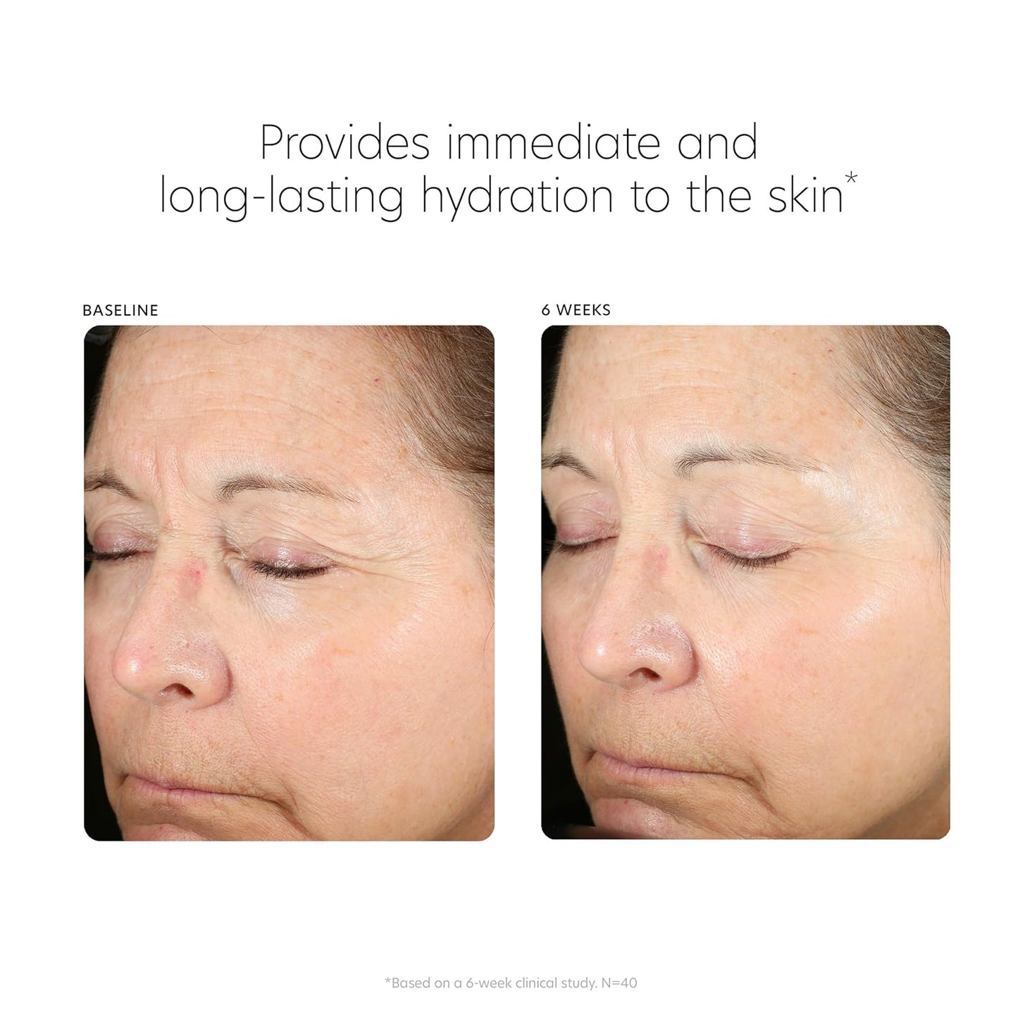 PCA SKIN Hyaluronic Acid Boosting Face Serum (1 fl oz)