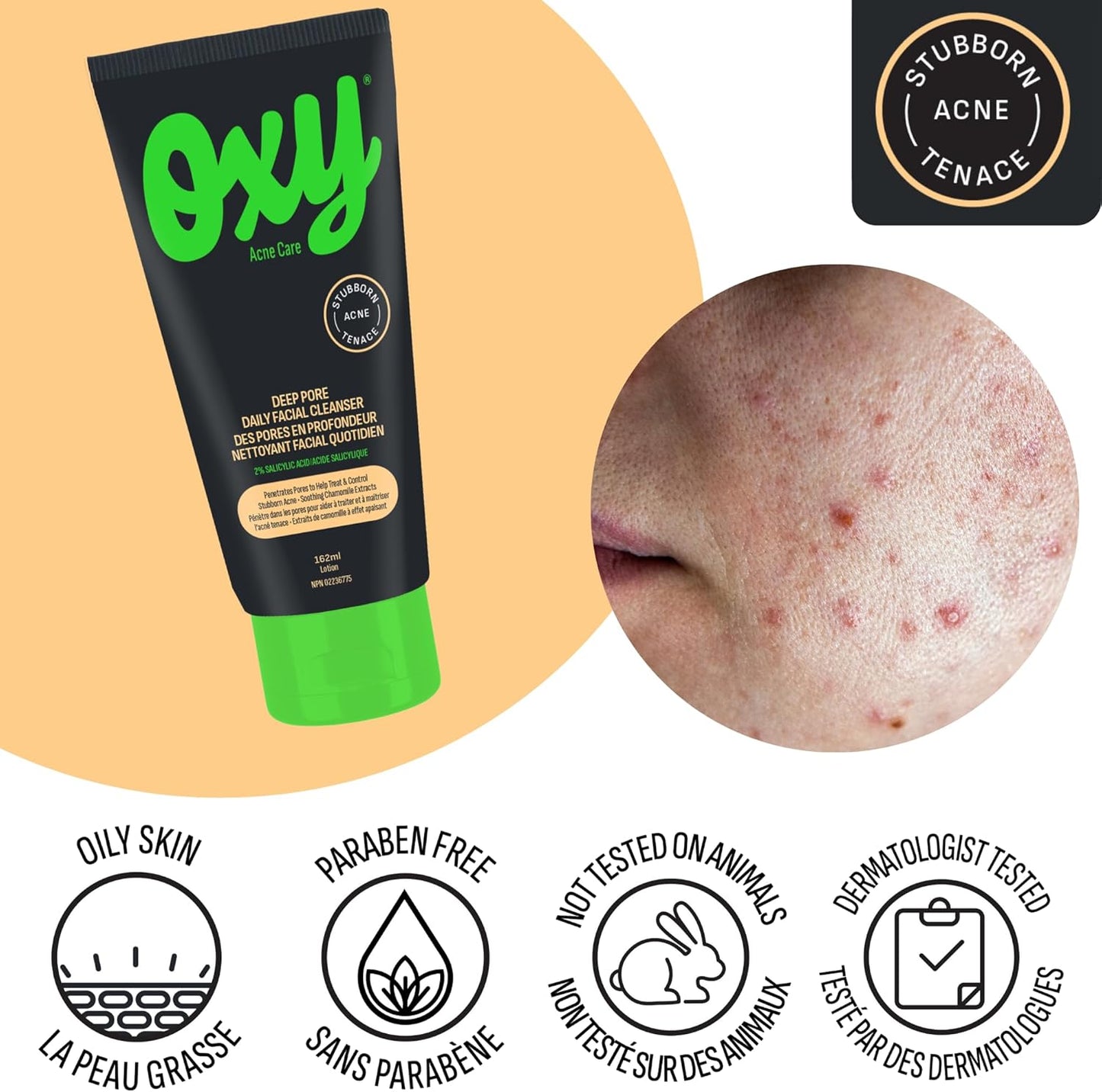 Oxy Deep Pore Daily Facial Cleanser - Salicylic Acid (2.0%) – Stubborn Acne Control - Helps Treat, and Prevent Breakouts – Paraben Free - Dermatologist Tested