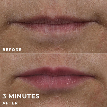 RoC Derm Correxion Lip Volumizer - Lip Plumper Peptide Treatment + Hyaluronic Acid & Vitamin E with Line Smoothing Eye Packette