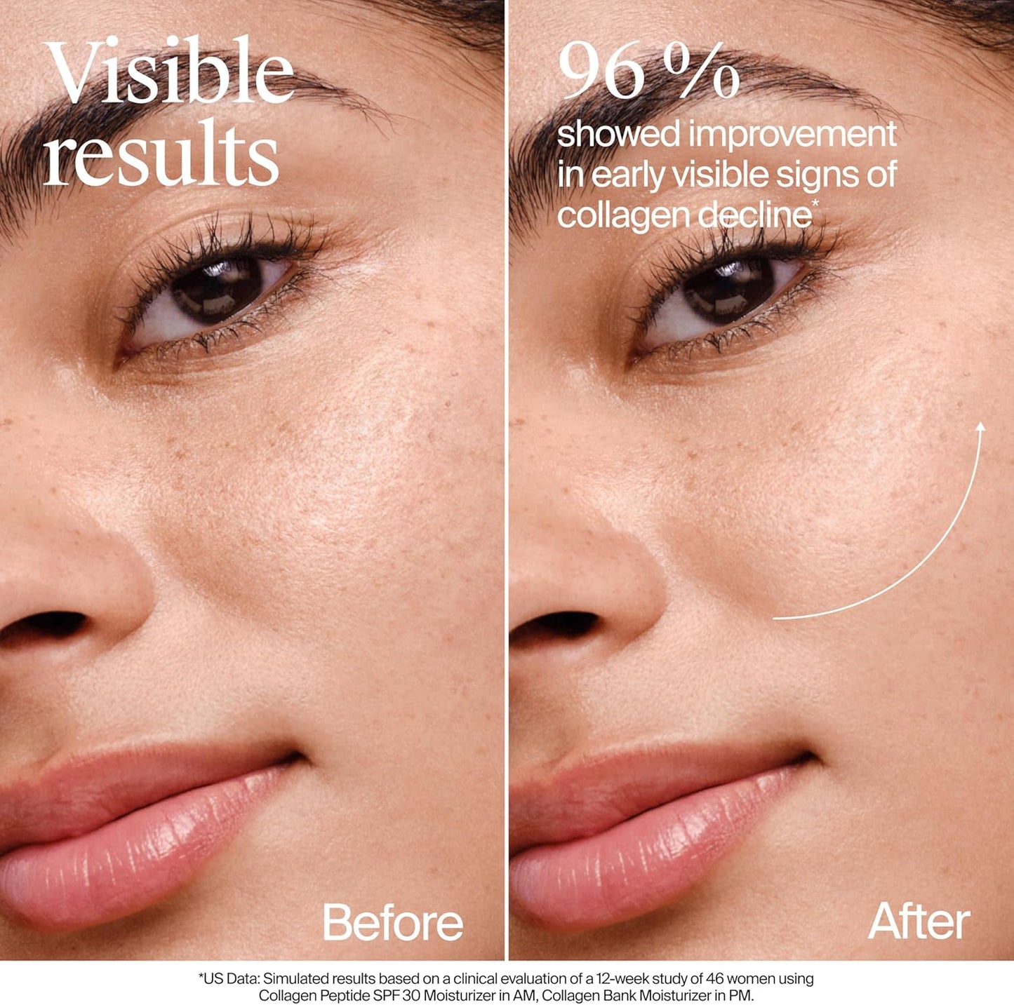 Neutrogena Collagen Bank Face Moisturizer, Daily Anti-Aging Neck Collagen Cream with Bakuchiol, Cream to Support Skin’s Natural Collagen for Visibly Plump Skin, 79 mL