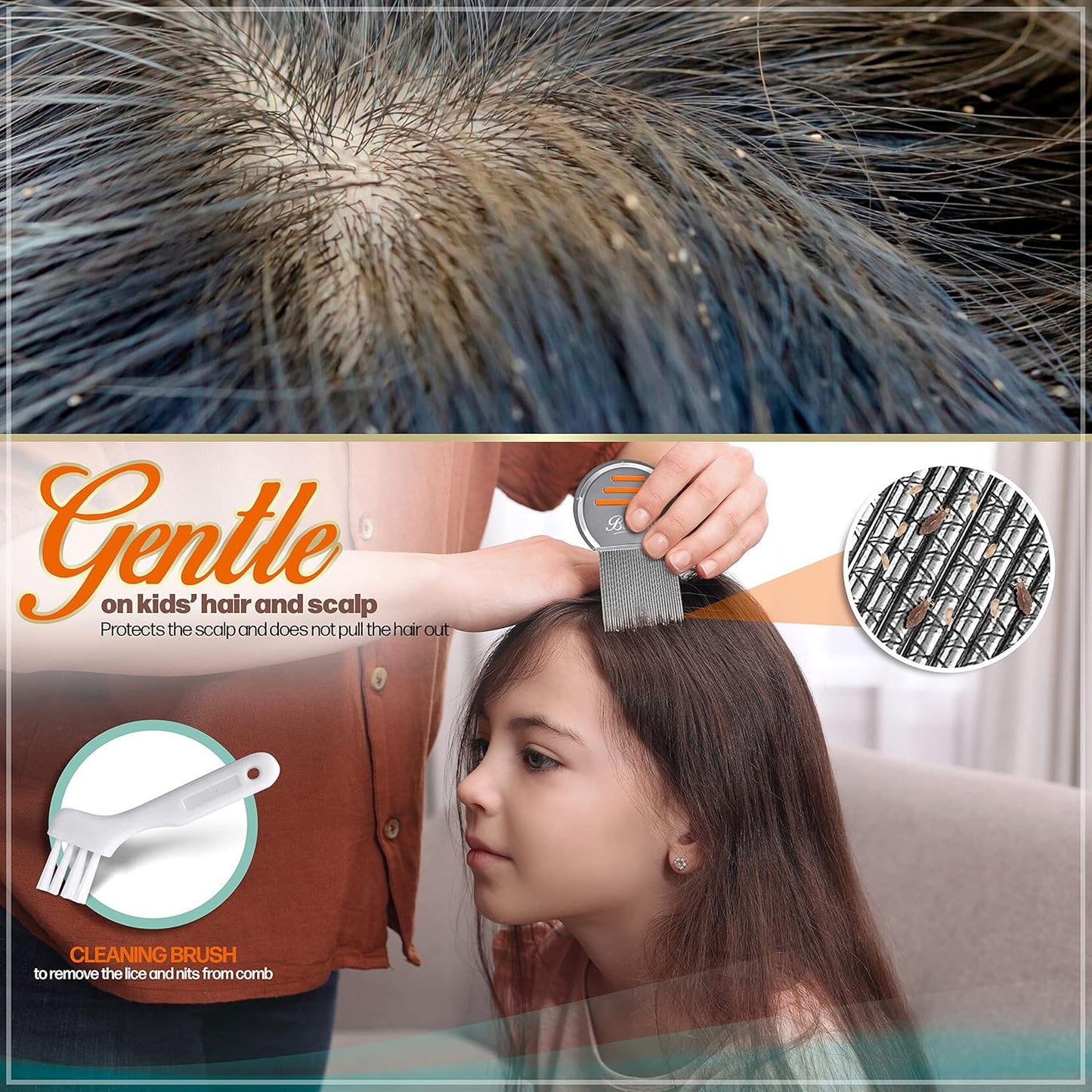 Bussani 虱子梳 – 304 不锈钢梳齿 – 适用于儿童、成人和宠物 – 防锈、可重复使用、易于清洁的猫狗跳蚤梳 - Peigne a Poux