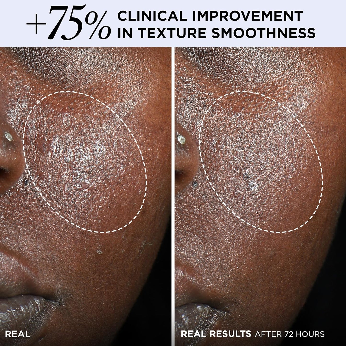 IT Cosmetics Confidence In A Cream Barrier Boost Face Moisturizer - Lightweight, Hydrating Barrier Cream for Sensitive Skin - Fragrance-Free Formula (60 g)